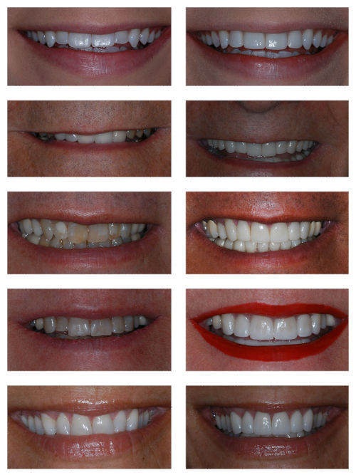 Smile Gallery
